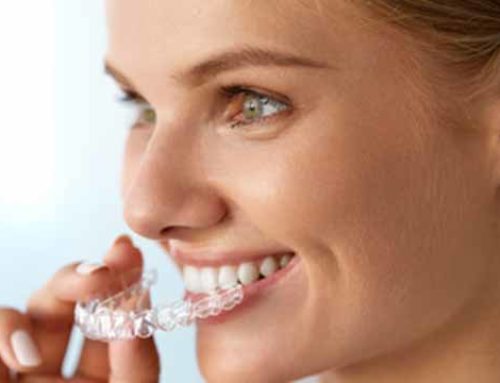 Dentist in Whitby, ON shares tips for oral hygiene during Invisalign treatment