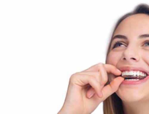 Dos and Don’ts during Invisalign treatment in Whitby