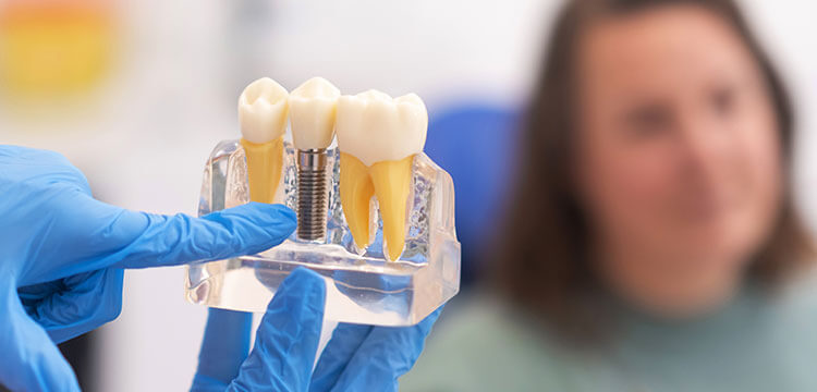 digital-impression-at-trinity-family-dental